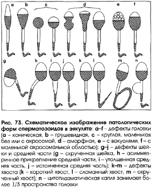chem-opasni-patologii-spermatozoidov chem-opasni-patologii-spermatozoidov