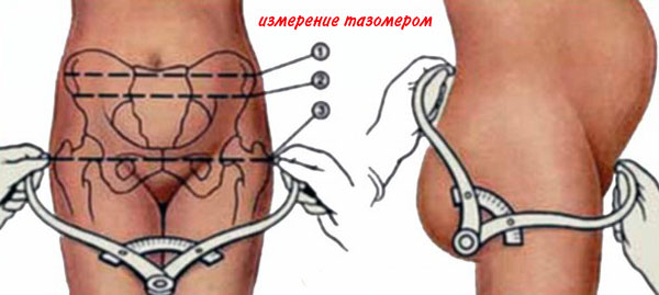 Боли в тазу и бедрах при беременности